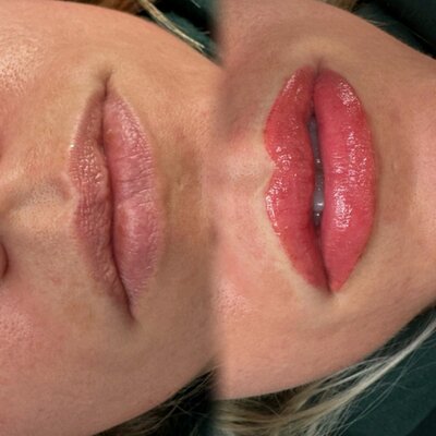 Lip Blush by Fawn Harper — client work from the studio portfolio.